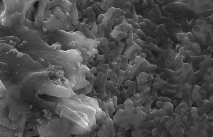 Микрофотография показывает, как клетки выглядят под сканирующим электронным микроскопом